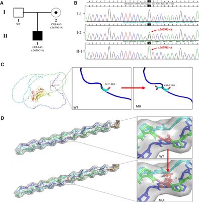 Case report: Preimplantation genetic testing for X-linked alport syndrome caused by variation in the COL4A5 gene